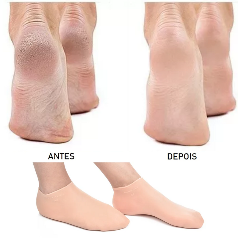 1 Par - Meias de Silicone Para Cuidado Dos Pés - Anti-Rachaduras